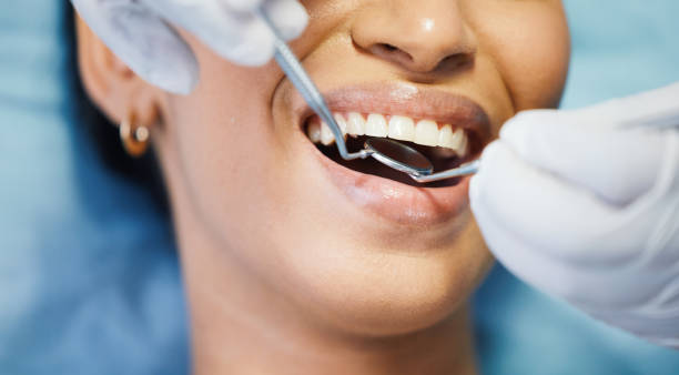 Best Emergency Treatment for Toothache in Boaz, AL